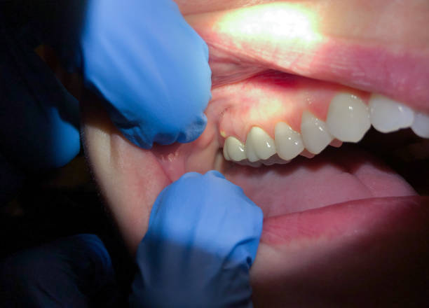 Best Cosmetic Emergency Dentistry in Walnutport, PA