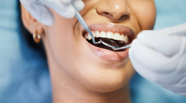 Best Emergency Tooth Extraction in Walnutport, PA